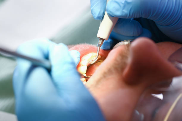 Best Emergency Denture Repair in Farmer City, IL